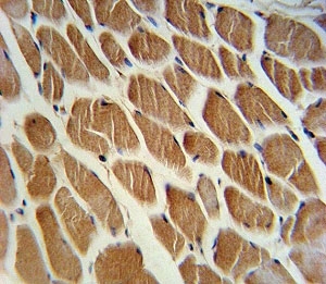 ACADL antibody immunohistochemistry analysis in formalin fixed and paraffin embedded human skeletal muscle.