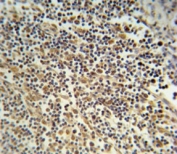 NLRP3 antibody immunohistochemistry analysis in formalin fixed and paraffin embedded human lymph tissue.