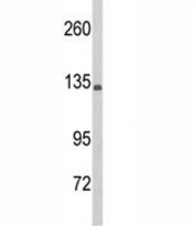 Western blot analysis of C5 antibody and HL-60 lysate