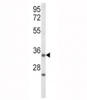 Western blot analysis of IGFBP2 antibody and human Jurkat cell lysate. Predicted/observed molecular weight ~35 kDa.