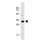 Western blot analysis of IGFBP2 antibody and human T-47D cell lysate. Predicted/observed molecular weight ~35 kDa.