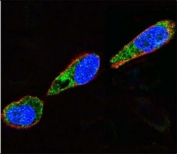 Confocal immunofluorescent analysis of Src antibody with A375 cells followed by Alexa Fluor 488-conjugated goat anti-rabbit lgG (green). Actin filaments have been labeled with Alexa Fluor 555 Phalloidin (red). DAPI was used as a nuclear counterstain (blue).