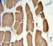 IHC analysis of FFPE human skeletal muscle with WNT5B antibody