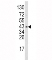 Western blot analysis of WNT5B antibody and mouse bladder tissue lysate. Predicted molecular weight ~40 kDa.