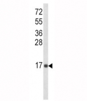 Western blot analysis of IL-8 antibody and MDA-MB468 lysate. Predicted molecular weight: ~8 kDa (monomer), ~16 kDa (dimer)
