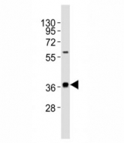 Western blot testing of MICA antibody at 1:1000 dilution + HeLa lysate