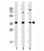 Western blot testing of MICA antibody at 1:2000 dilution. Lane 1: U-87 MG lysate; 2: A431; 3: Jurkat; Predicted molecular weight: ~43kDa but may be observed at 38-62kDa depending on truncation and glycosylation level.