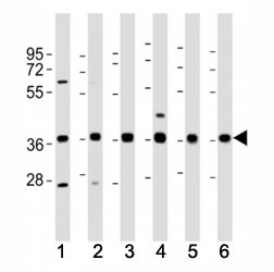 Western blot testing of MICA antibody at 1:2000 dilution. Lane 1: Jurkat lysate; 2: Daudi ; 3: A431; 4: MCF-7; 5: U-87MG; 6: THP-1; Predicted molecular weight: 38-62 kDa depending on glycosylation level.