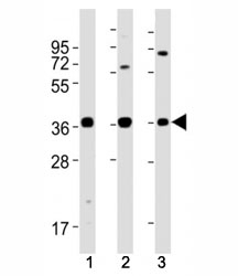 Western blot testing of MICA antibody at 1:2000 dilution. Lane 1: U-87 MG lysate; 2: A431; 3: Jurkat; Predicted molecular weight: 38-62 kDa depending on glycosylation level.