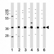 Western blot testing of MICA antibody at 1:2000 dilution. Lane 1: Jurkat lysate; 2: Daudi ; 3: A431; 4: MCF-7; 5: U-87MG; 6: THP-1; Predicted molecular weight: ~43 kDa but may be observed at 38-62 kDa depending on truncation and glycosylation level.