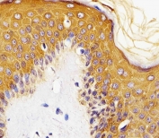IHC staining of FFPE human skin with MICA antibody. HIER: boil tissue sections in pH6, 10mM citrate buffer, for 10-20 min and allow to cool before testing.