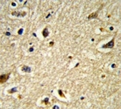 IHC analysis of FFPE human brain tissue stained with CYP2E1 antibody