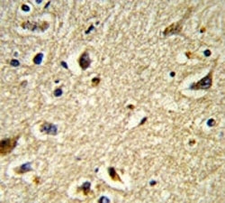 IHC analysis of FFPE human brain tissue stained with CYP2E1 antibody