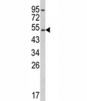 Western blot analysis of CYP2E1 antibody and K562 lysate. Predicted molecular weight ~56 kDa.