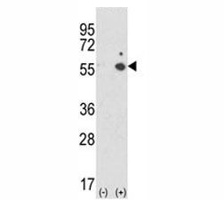 Western blot analysis of ICAM-1 antibody and 293 cell lysate (2 ug/lane) either nontransfected (Lane 1) or transiently transfected with the ICAM1 gene (2).~