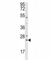 Western blot analysis of RAB7 antibody and K562 lysate. Expected molecular weight ~23 kDa.