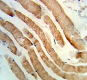 IHC analysis of FFPE human skeletal muscle stained with RAB7 antibody