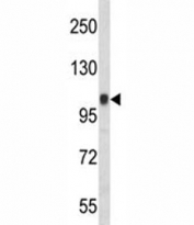 Western blot analysis of Integrin beta 3 antibody and CEM lysate. Expected molecular weight: 87-110 kDa depending on glycosylation level.