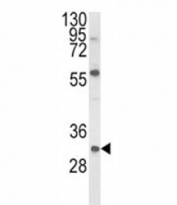 Western blot analysis of GDNF antibody and mouse NIH3T3 lysate.