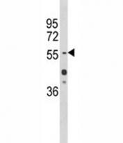 Western blot analysis of HNF1A antibody and mouse liver tissue lysate. Predicted molecular weight ~67 kDa, commonly observed at 67-80 kDa.