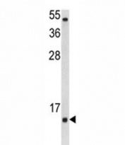 Western blot analysis of SOD1 antibody and Jurkat lysate. Predicted molecular weight: ~16 kDa.