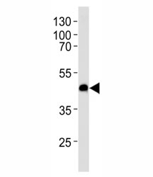 Western blot analysis of lysate from U-251 MG cell line using CXCR7 antibody at 1:1000 for each lane. Predicted molecular weight ~43 kDa.~