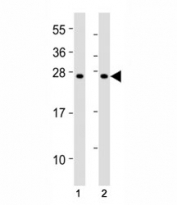 Western blot testing of SOCS1 antibody at 1:2000 dilution. Lane 1: mouse thymus lysate; 2: rat spleen lysate; Predicted molecular weight ~ 24 kDa.