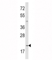 Western blot analysis of IL-12 antibody and MDA-MB231 lysate. Predicted molecular weight ~25 kDa (unmodified), ~35 kDa (glycosylated).