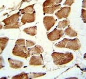 IHC analysis of FFPE human skeletal muscle stained with TAZ antibody