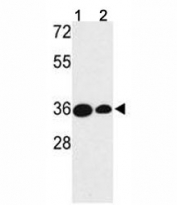 Western blot analysis of TAZ antibody and (1) MDA-MB231 and (2) NCI-H460 lysate. Expected/observed molecular weight ~33kDa