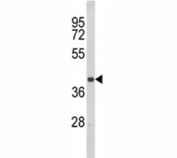 Western blot analysis of CCR3 antibody and Jurkat lysate. Visualized from 40~55 kDa