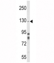 Western blot analysis of Integrin alpha 1 antibody and mouse cerebellum tissue lysate. Predicted molecular weight: ~131/150+ kDa (unmodified/glycosylated).