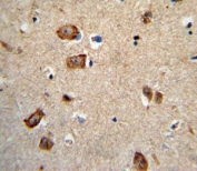 IHC analysis of FFPE human brain tissue stained with Integrin alpha 1 antibody
