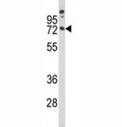 Western blot analysis of MAG antibody and A375 lysate