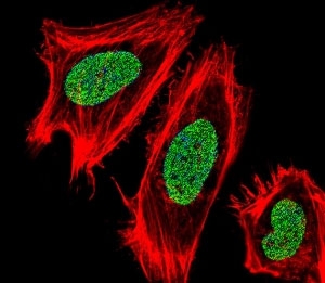 Fluorescent confocal image of HeLa cells stained with UHRF1 antibody. Alexa Fluor 488 conjugated secondary (green) was used. UHRF1 immunoreactivity is localized to the nucleus.