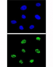 Confocal immunofluorescent analysis of p73 antibody with 293 cells followed by Alexa Fluor 488-conjugated goat anti-rabbit lgG (green). DAPI was used as a nuclear counterstain (blue).