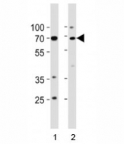 p73 antibody western blot analysis in 1) human K562 cell line and 2) mouse brain tissue lysate.