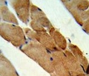 IHC analysis of FFPE human skeletal muscle stained with RANKL antibody