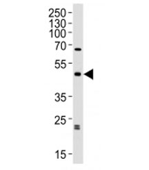 Western blot analysis of lysate from human brain tissue lysate using ABHD12 antibody diluted at 1:1000. Predicted molecular weight ~45 kDa.