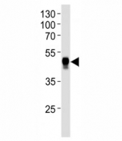 Western blot analysis of lysate from human placenta tissue lysate using HLA-G antibody diluted at 1:1000.