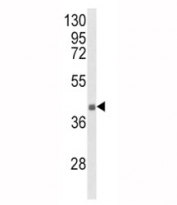Western blot analysis of HLA-G antibody and NCI-H460 lysate. Predicted molecular weight ~40 kDa.