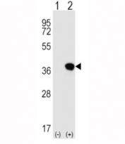Western blot analysis of HLA-G antibody and 293 cell lysate either nontransfected (Lane 1) or transiently transfected (2) with the HLA-G gene.