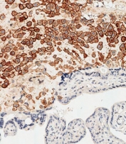IHC analysis of FFPE human placenta stained with HLA-G antibody. HIER: boil tissue sections in pH 9 EDTA buffer for 20 min and allow to cool before testing.