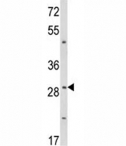 Western blot analysis of TTP antibody and WiDr lysate