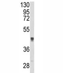 Western blot analysis of TGN46 antibody and MCF-7 lysate.~