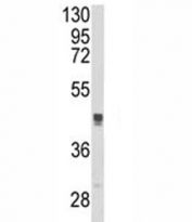 Western blot analysis of TGN46 antibody and MCF-7 lysate. Expected molecular weight: 38-120 kDa depending on glycosylation level.