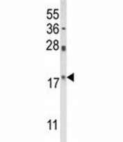 Western blot analysis of PIN1 antibody and HL-60 lysate