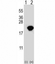 Western blot analysis of PIN1 antibody and 293 cell lysate either nontransfected (Lane 1) or transiently transfected (2) with the PIN1 gene. Expected molecular weight ~18kDa.