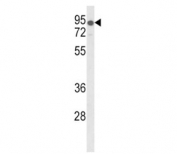 Western blot analysis of LDLR antibody and mouse lung tissue lysate. Expected molecular weight: 95-160 kDa depending on glycosylation level.