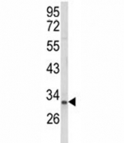 Western blot analysis of NKX3.1 antibody and MCF-7 lysate. Predicted molecular weight ~28 kDa, observed at 28-38 kDa.